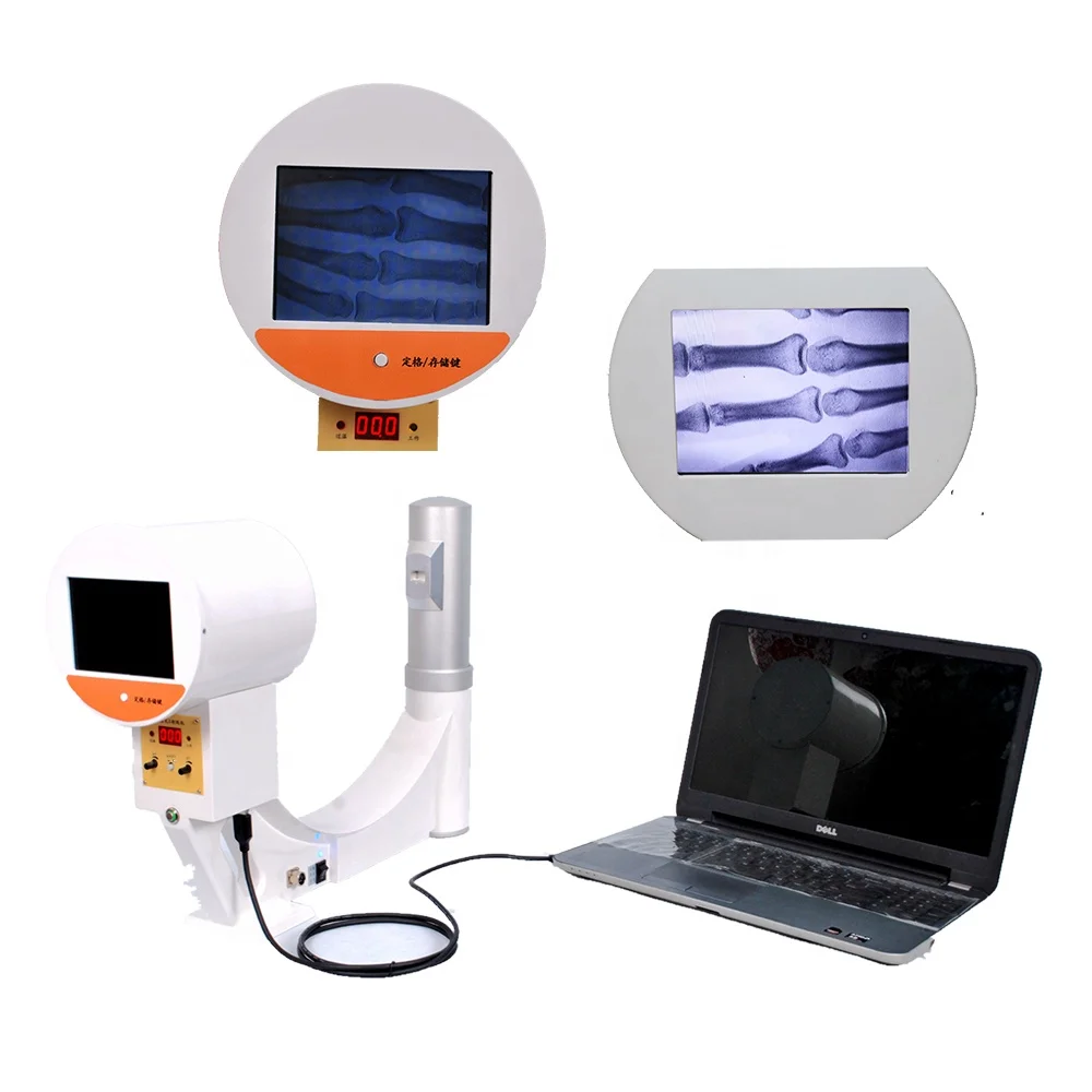 Intensificador de imagen de rayos x, productos objeto de negociación, fluoroscopia digital, MSLPX32