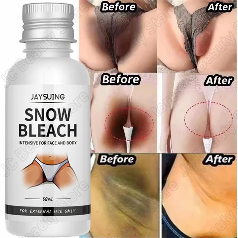 Whitening Cream Private Parts Underarm Bleaching Serum Whiten Butt Knee Brighten Inner Thigh Intimate Parts Dark Remove Melanin