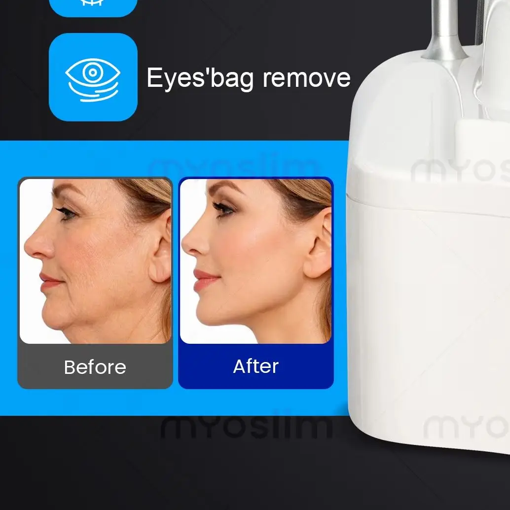 V‑NINE 5IN1 Multifunctional Slimming Machine Automatic Roller 40KHZ Cavitation Vacuum RF Body Sculpting Cellulite Reduction