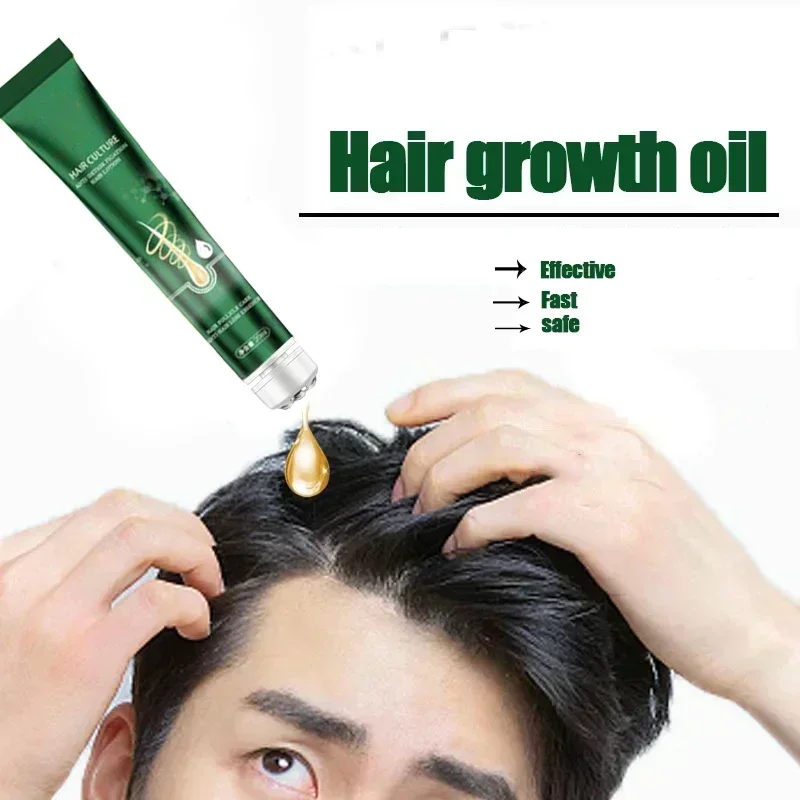 Hot sales Hair Growth Oil Fast Effective Baldness Repair Hereditary Postpartum Hair Loss Seborrheic Hair Loss