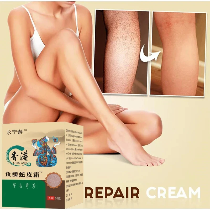 Frango Pele Remoção Body Care Cream, Diluir e remover células mortas da pele, Pore Spot, Clareamento maçante, Hidratante