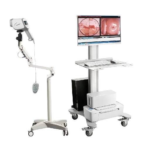 Kernel Colposcopio KN 2200A 2.1MP Gynecological Diagnostic Apparatus Colposcopy Machine For Vulva Examination