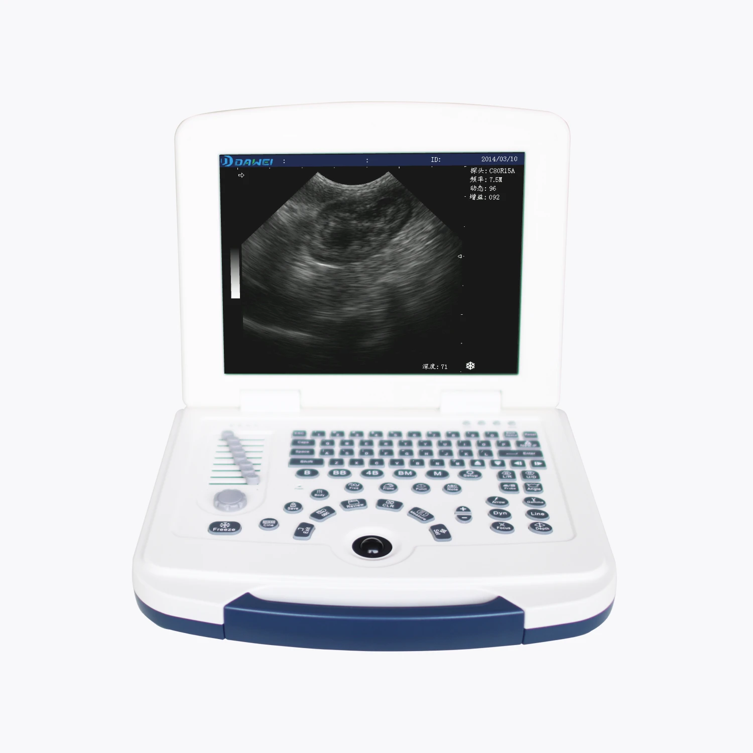 

Dawei Laptop Equine Kidney Lung Limb Leg Laryngeal Ulltrasound