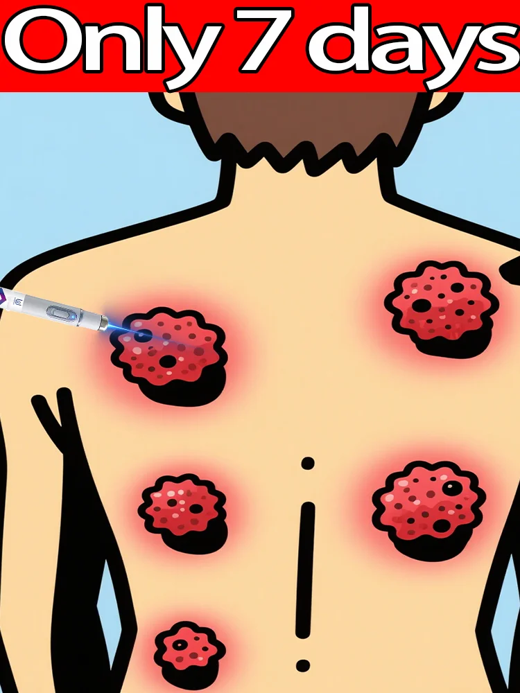 

Hᴏᴛ sᴇʟʟɪɴɢ ʙʟᴜᴇ ʟɪɢʜᴛ ᴘᴇɴ ᴛᴏ sᴏʟᴠᴇ ʙᴏᴅʏ ᴡᴀʀᴛs, ᴡᴀʀᴛ ᴄᴀʀᴇ ᴛᴏᴏʟs