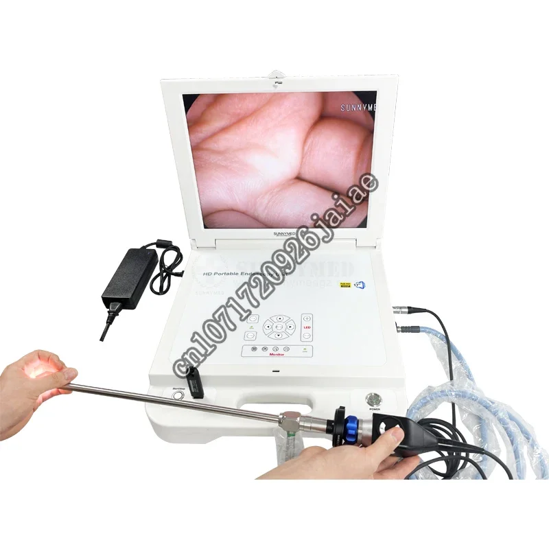 SY-PS046A HD Portable 17 inch hysteroscope gynecological FULL  endoscope  system