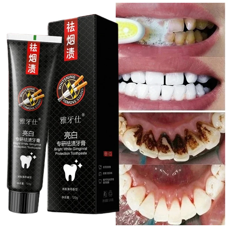 Fast Remove Smoke Stains Toothpaste Remove Plaque Stains Oral Hygiene Cleaning Fresh Breath Teeth Whiten Oral Health Care 120g