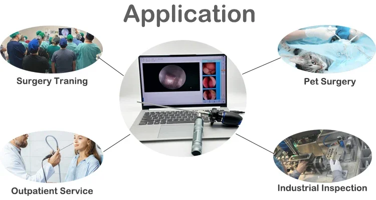 Câmera do endoscópio USB HD, otorrinolaringologista médico