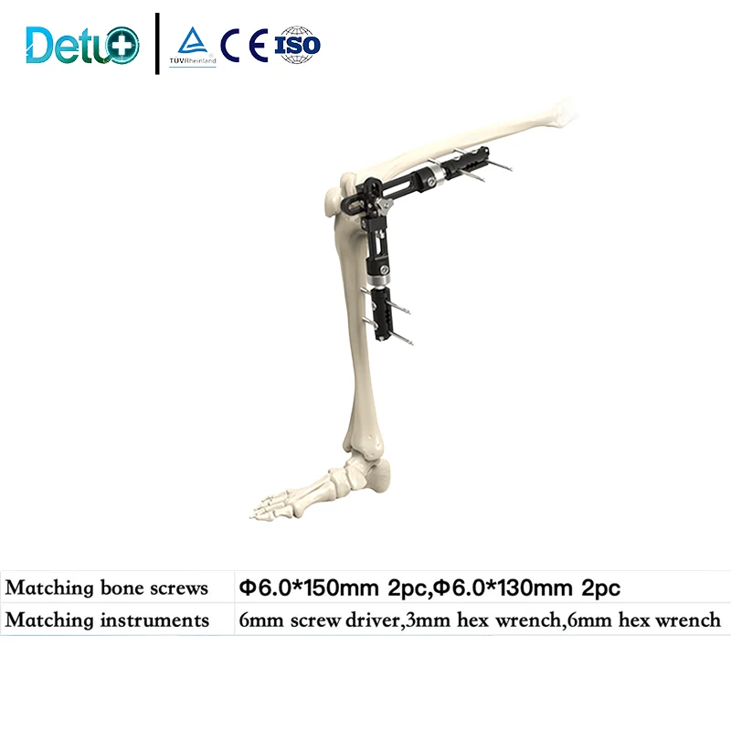 Orthopedic External Fixator,Knee Joint External Fixator For Knee Joint Fracture Fixation, Factory Direct Supply