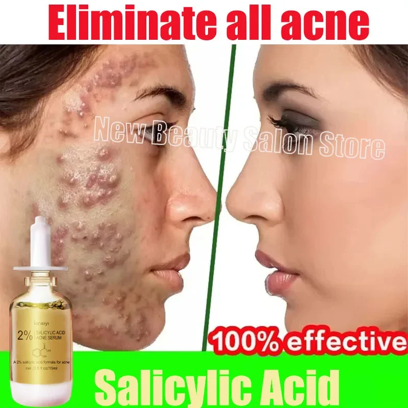 

Salicylic Acid Acne Removal Face Serum Acne Treatment Repair Spots Scar Moisturizing Oil Control Shrink Pore Skin Care Products