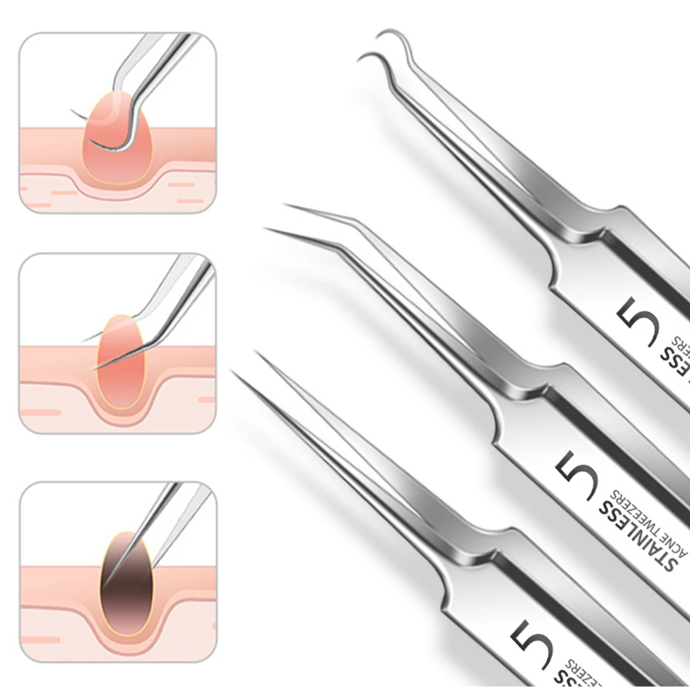 الألمانية فائقة غرامة مشبك البثور الملقط ، أداة إبرة حب الشباب ، البثور الخلية ، صالون تجميل خاص كشط وإغلاق قطعة أثرية ، رقم 5