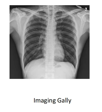 Medical Removable DR Digital Imaging System JH-500R Medical X-ray System 5KW 100mA Removable DR X-ray System