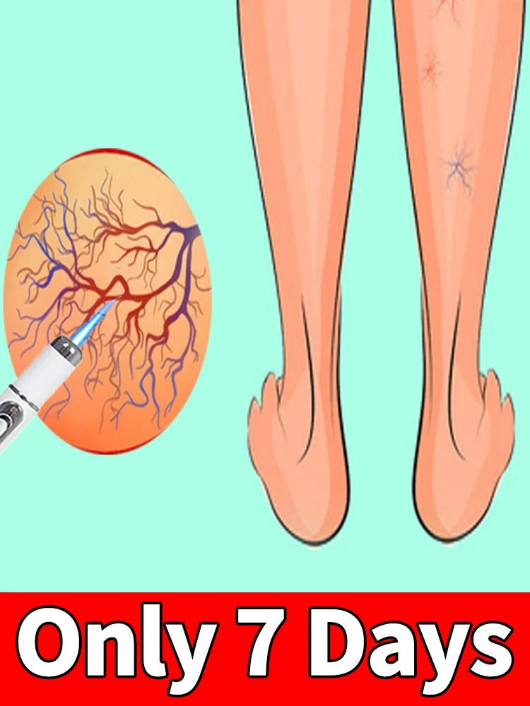 

Solve All Leg Problems