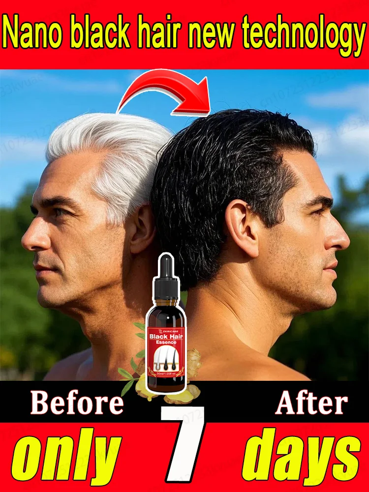 

Powerful Hair Darkening Serum, Reverse Gray Hair & Prevent White Hair for Women & Men, Natural Herbal Fast Results,