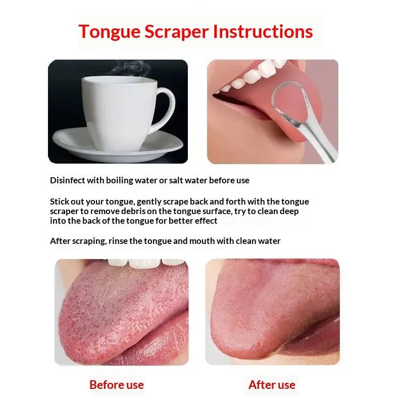 Stainless Steel Tongue Scraper Set Reusable Metal Tongue Cleaner For Oral Hygiene, Fresh Breath Tongue Scraper For Adults