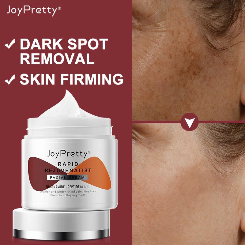 

Joypretty Face Cream Anti-wrinkle Dark Spot Remover Whitening Moisturizing Korean Cosmetics Skin Care Beauty Health