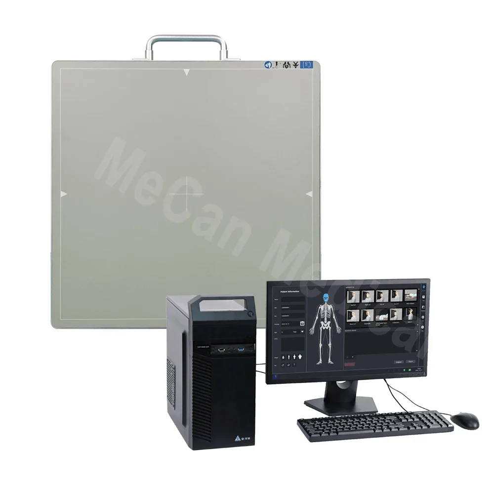 Top Quality Digital Flat Panel Detector X Ray, Portable Wireless Flat Panel Detector