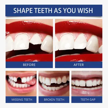 10 best sales Diş dolgusu - №3