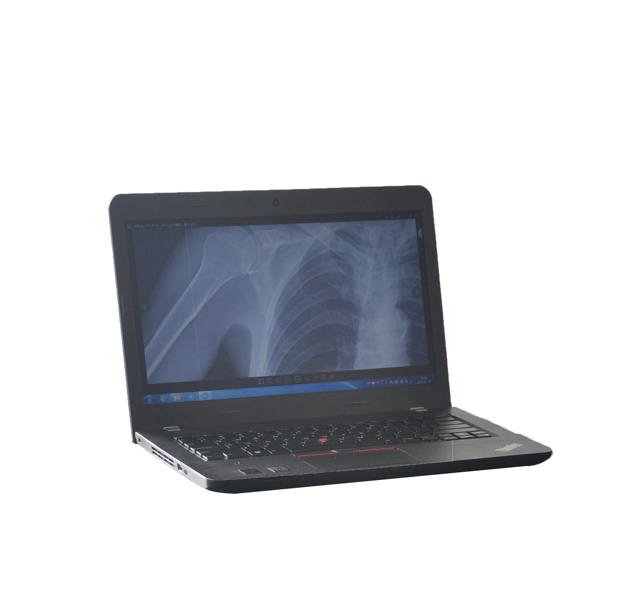 2026 New 6.3KW Digital Portable X-ray System With Electric Power