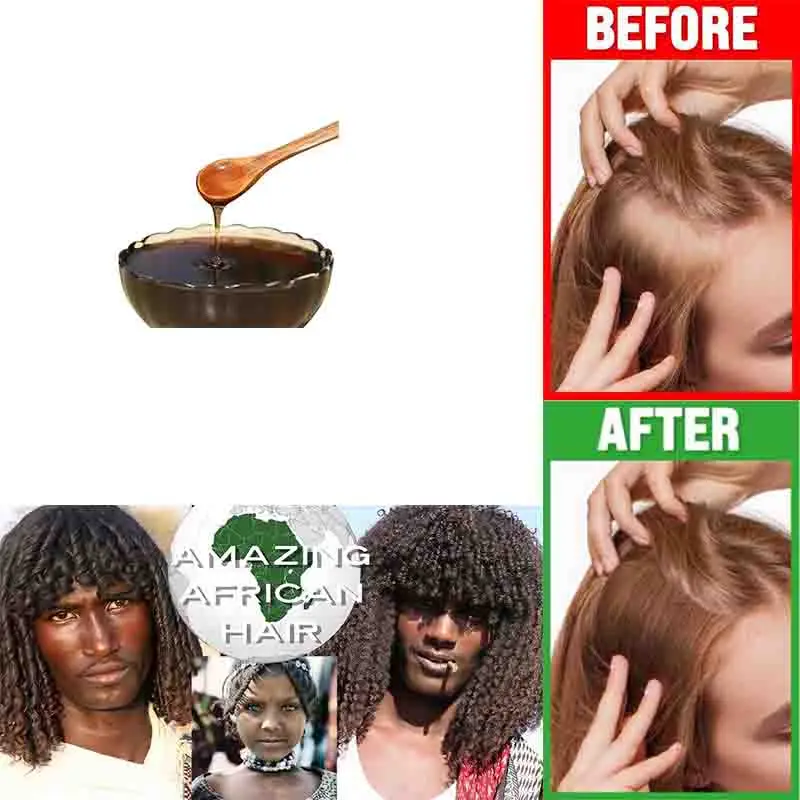 Naturally Regrow Hair Postpartum Hair Loss Treatment Using South African Tribal Herbal Shampoo Stop Hair Fall Keratin Supplement