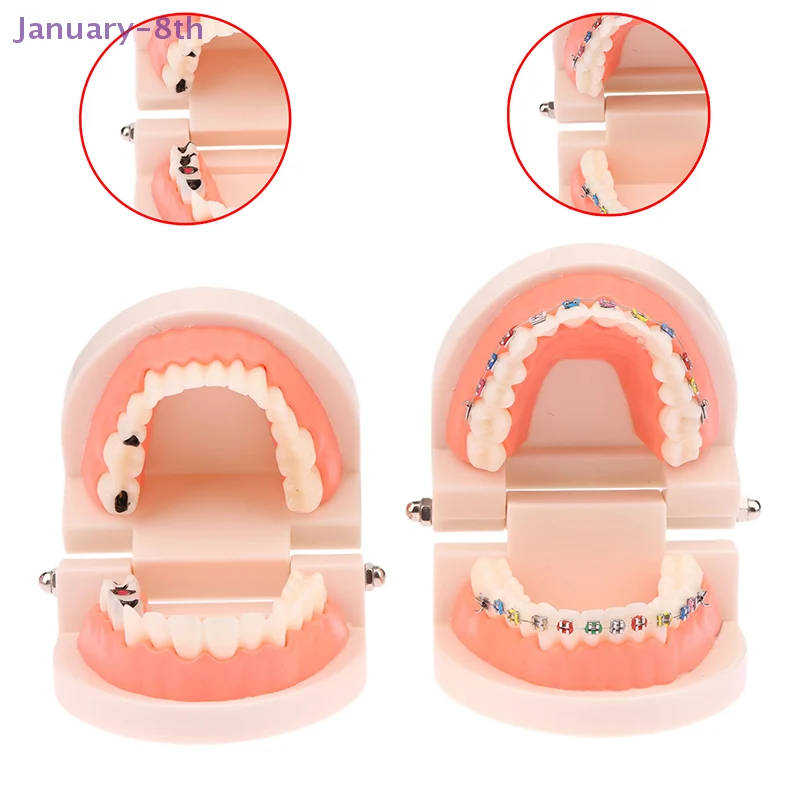 Dental Teaching Model Standard Dental Orthodontic Teeth Model Dentist Lab Tooth Model Teaching Tools