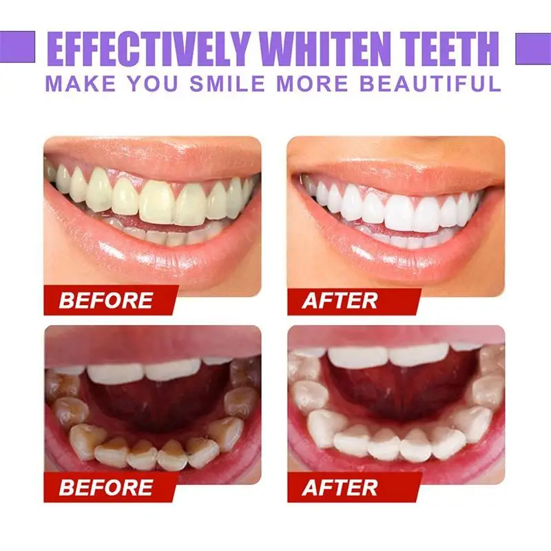 Whitening Tooth Toothpaste Freshen Breath Remove Smoke Stains Oral Hygiene Clean Effectively Removal Yellow Teeth Dental Care