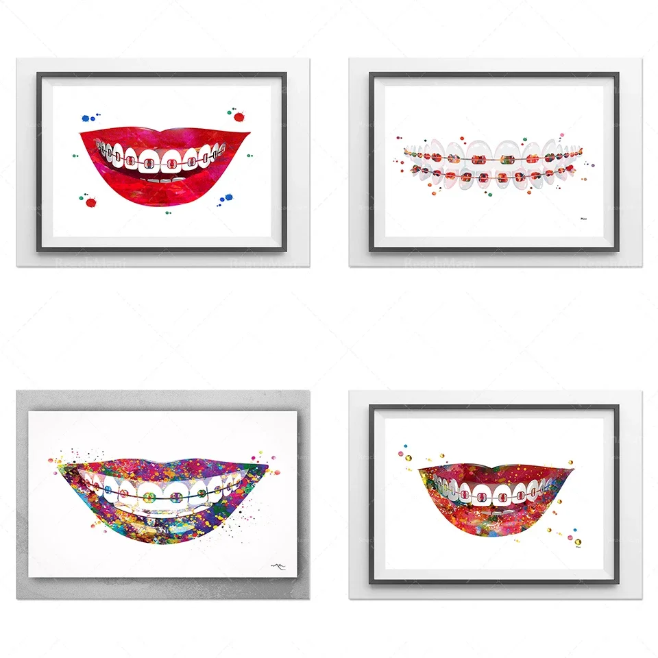 Dental Art Print Braces Aquarelle Dents Anatomie Art Poster Stomatology Dentist Clinic Wall Art Teeth Braces Print Dental Care O