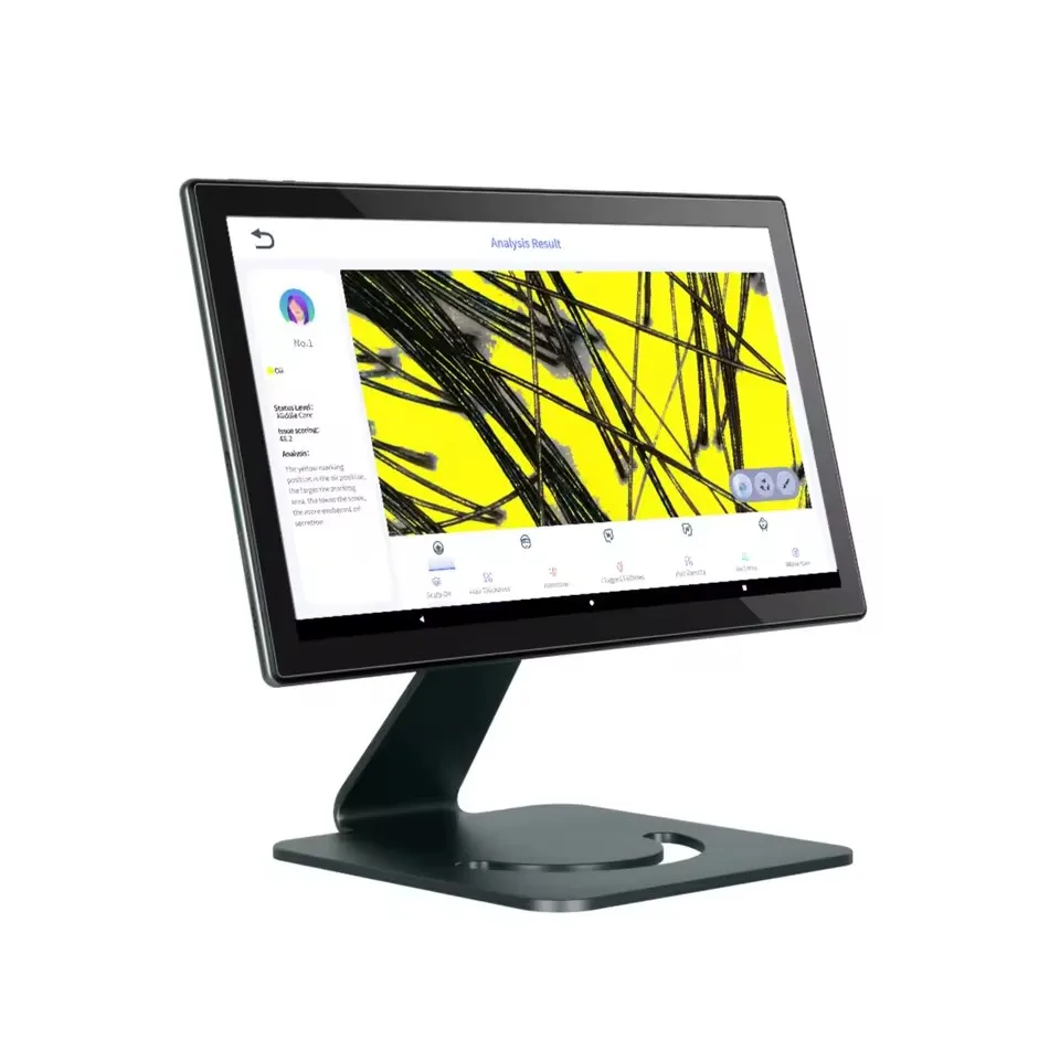 ParametersName: AI Smart Scalp Warranty: 1 Year Screen Size: 14.1 Inch Spectrum：3 Spectra (RGB+UV+PL) Available Language：4 Langu