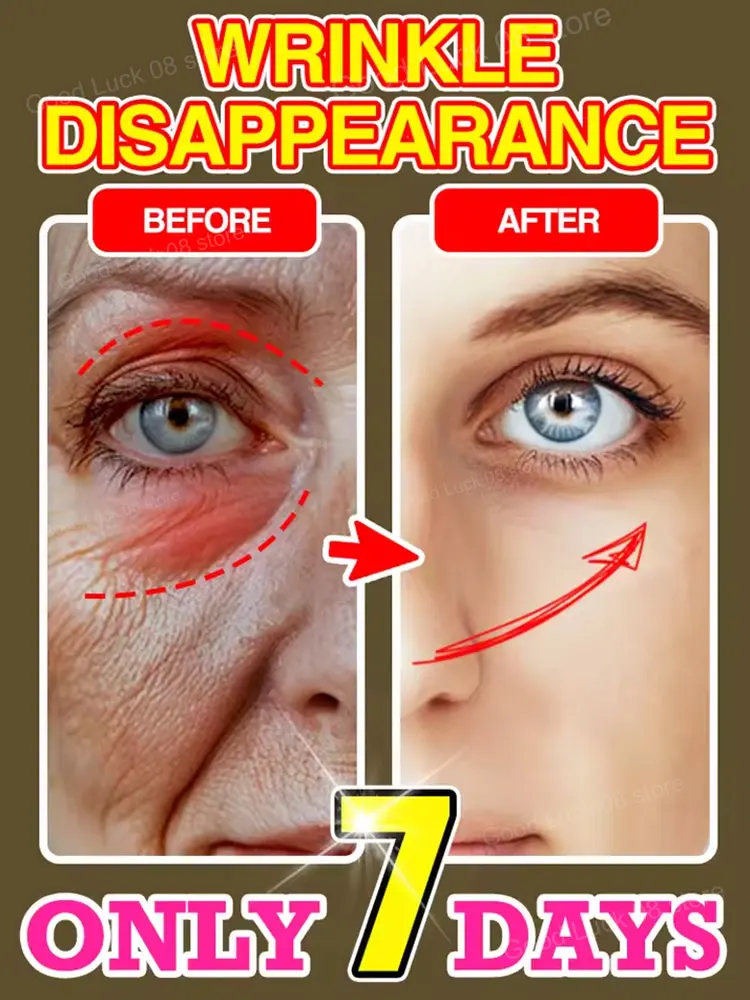 

Anti-wrinkle Younger 100%