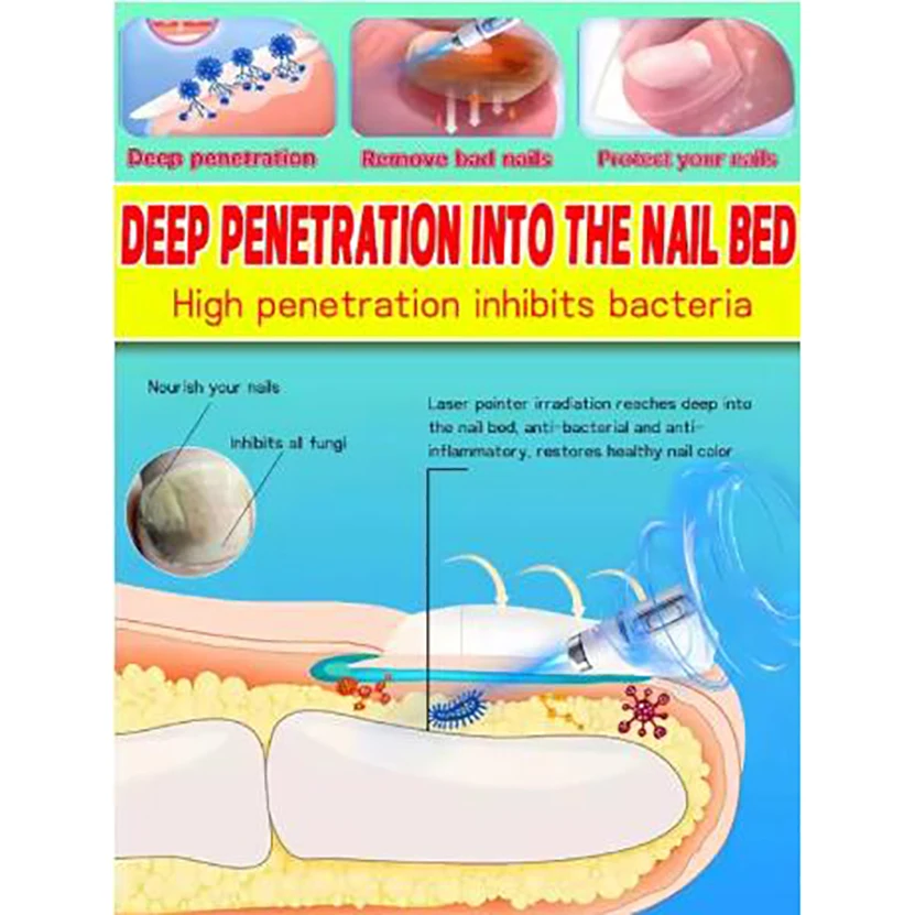 2025 First Generation Upgraded War Repair Warfts Root Quickly - 100% Brand New Compatible Quality