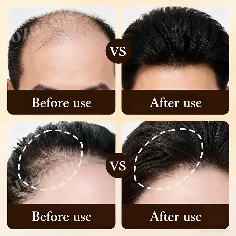 العناية بالتطهير 2 في 1، مغذية، خفيفة وغير دهنية