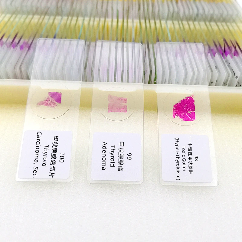 

100Pcs Teaching Microscope Human Pathology Slides Fixed Set