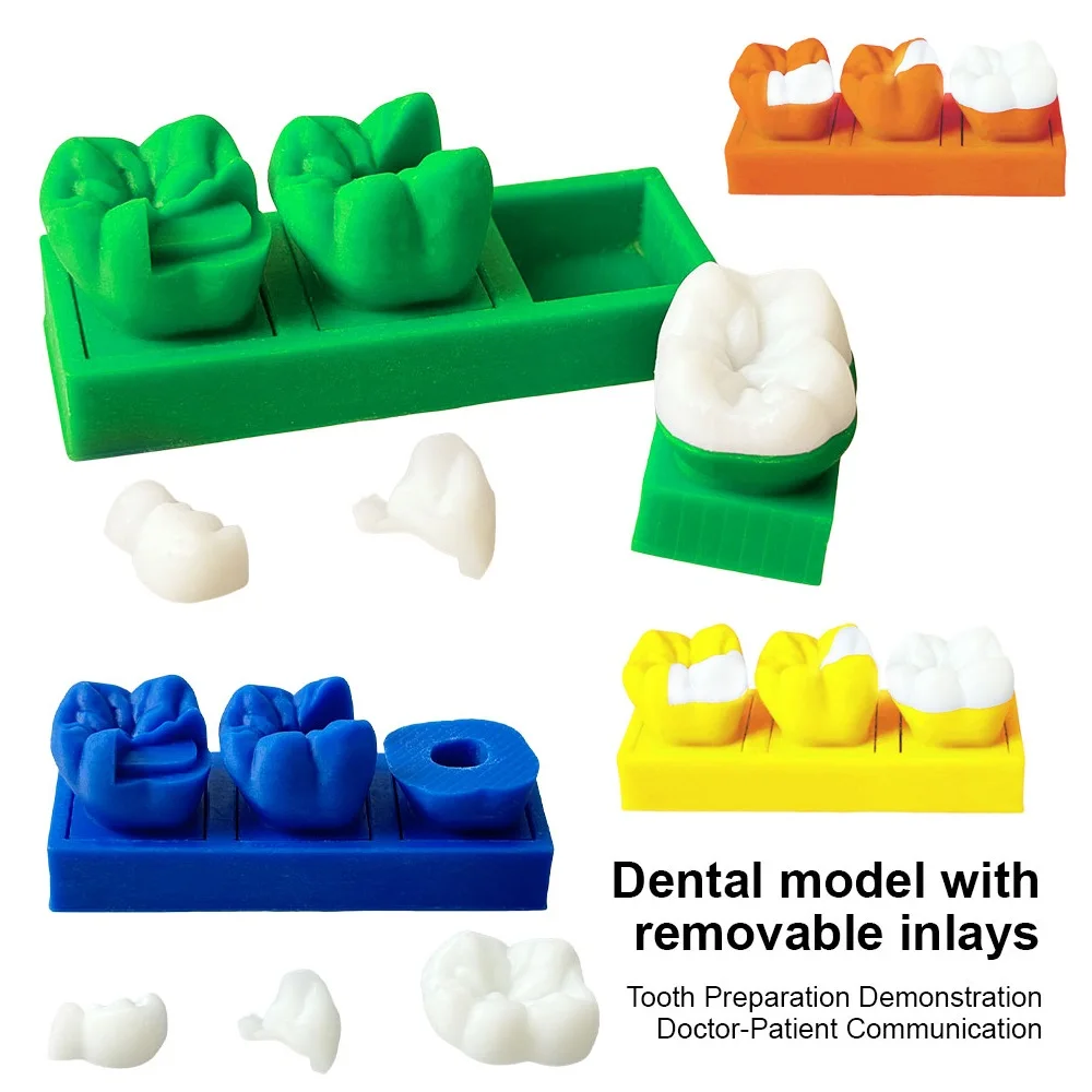 Dental Model With Removable Inlays Molar Tooth Preparation Study Model Restorative Cavity Filling Teaching Model Dentistry Tools