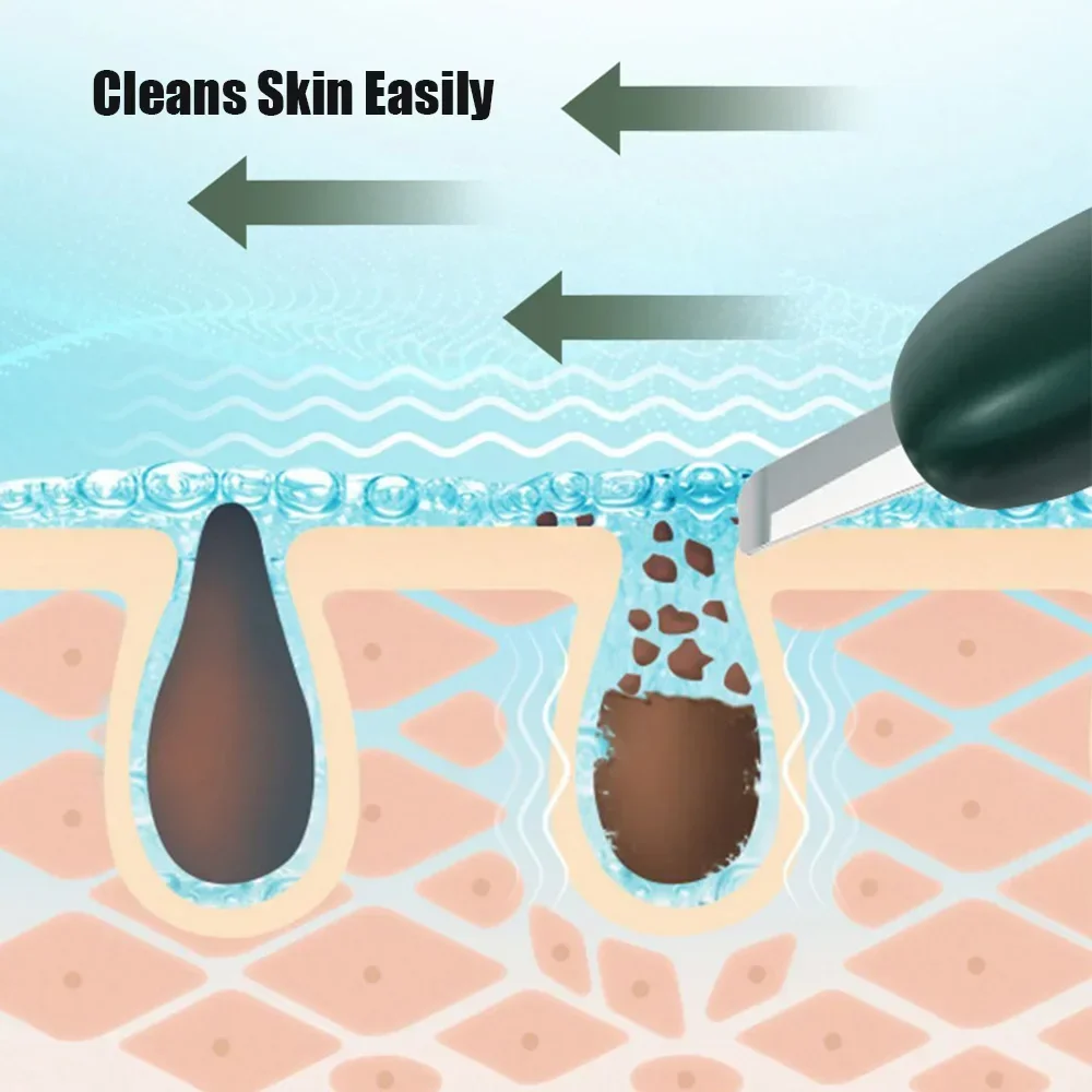 手動フェイシャルスクラバー,角質除去フェイシャルピーリング,ディープスキンクリーニング,にきび毛穴クレンザー,美容ツール