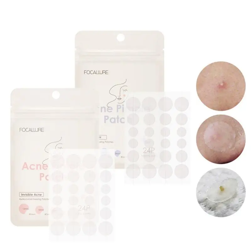 Acne Pimple Patch Stickers Pimple Remover Tool Absorb Pus And Oil Acne Patch Huidverzorging Als Beschermhoes 24 Patches