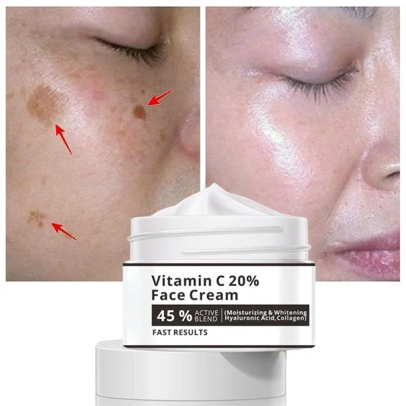 

Effective Whitening Freckle Cream Remove Melasma Acne Spot Pigment Melanin Dark Spots Pigmentation Moisturizer Skin Care