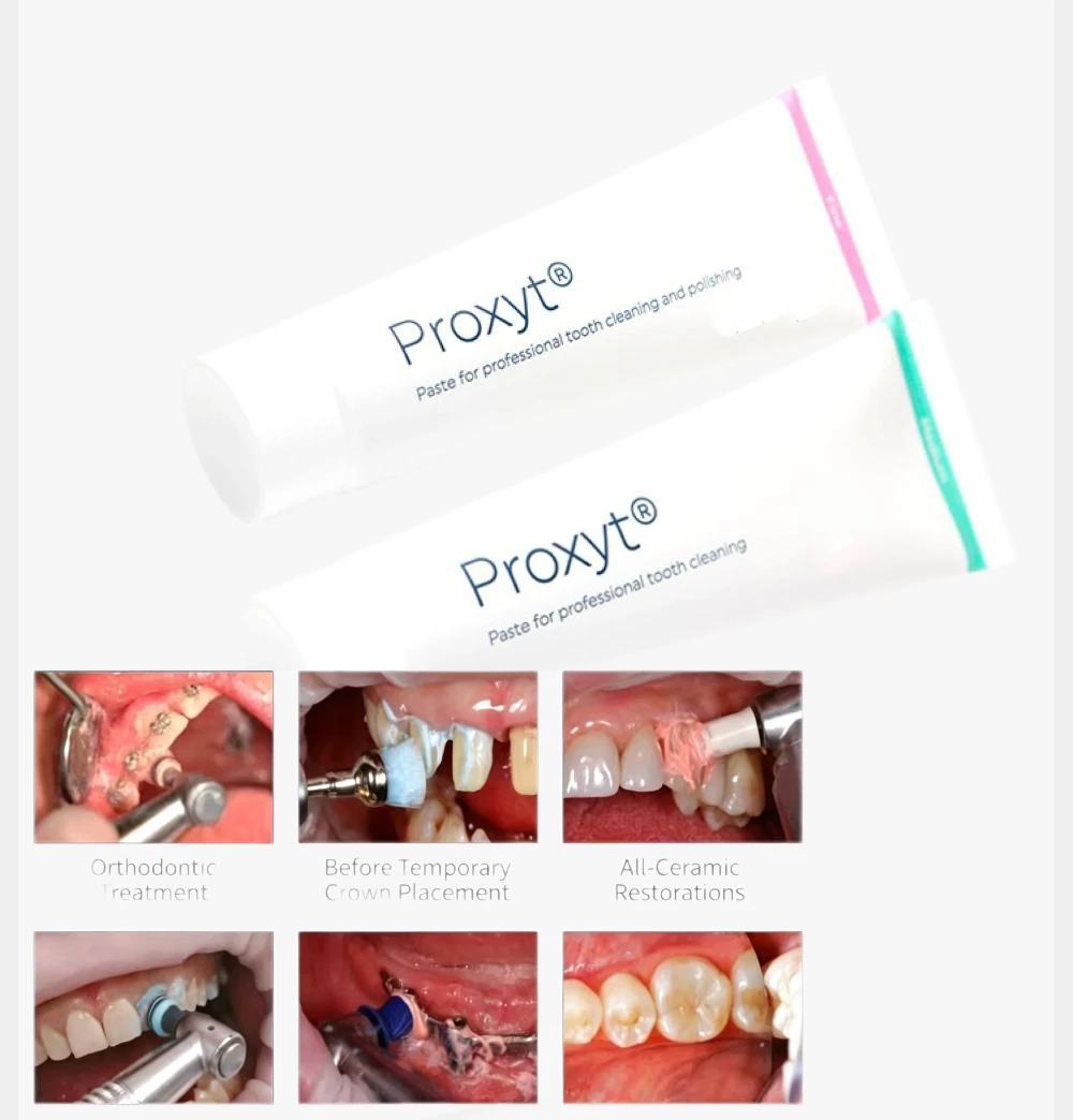 80gDental Prophy Polishing Paste Multiple Grit Options Fluoride & Fluoride Free For Teeth Prosthetics Surface Cleaning Polishing