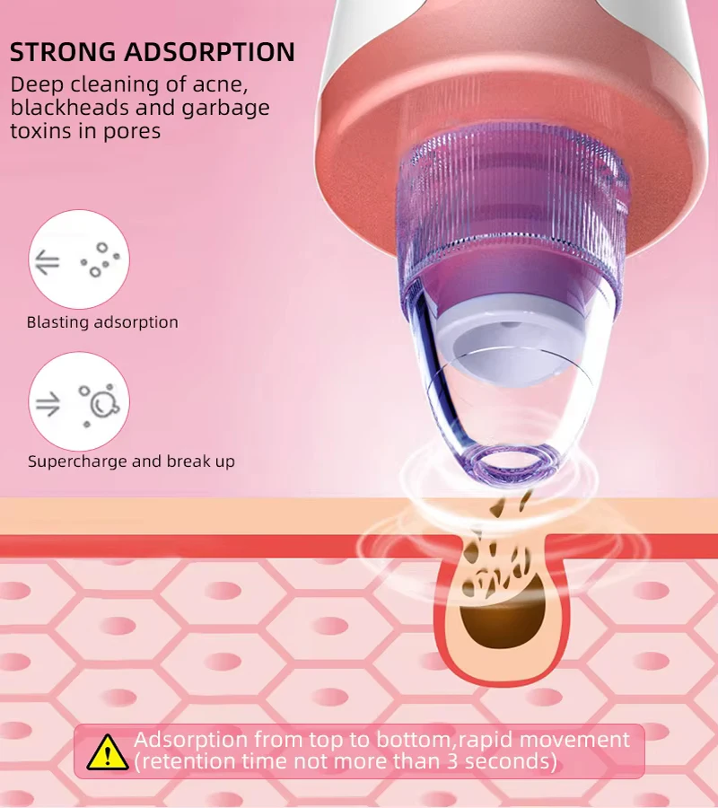 เครื่องดูดสิวเสี้ยนไฟฟ้าสำหรับใช้ในบ้าน กำจัดเซลล์ผิวที่ตายแล้ว สิวเสี้ยน สิวอักเสบบนใบหน้า เครื่องดูดสิวเสี้ยนแบบสุญญากาศ