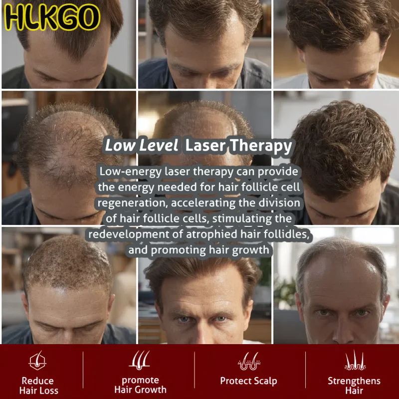 

LLLT Шапочка для роста волос 650 нм с инфракрасным светом, профессиональный шлем для лечения выпадения волос для утолщения волос