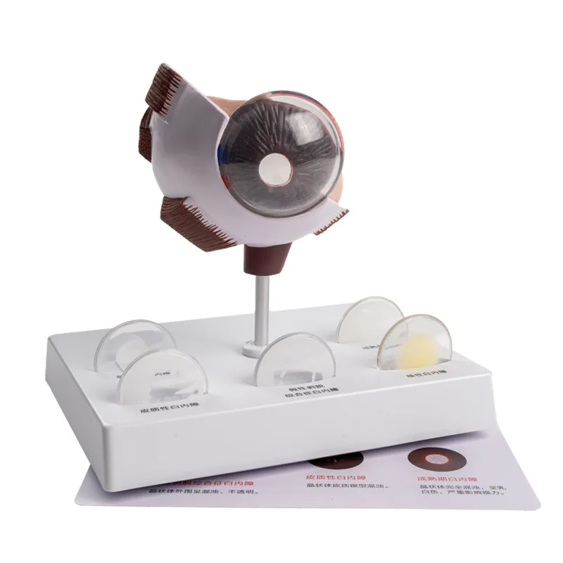 

Негабаритная анатомическая модель ока катаракта, анатомия человеческого глаза, рожка и линза, медицинские науки, образовательное оборудование, обучающий инструмент