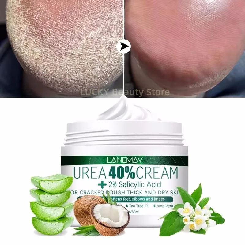 

Anti Drying Feet Cream Heel Cracking Repair Products Exfoliation Dead Skin Beriberi Removal Soften Moisturizing Hand Feet Care