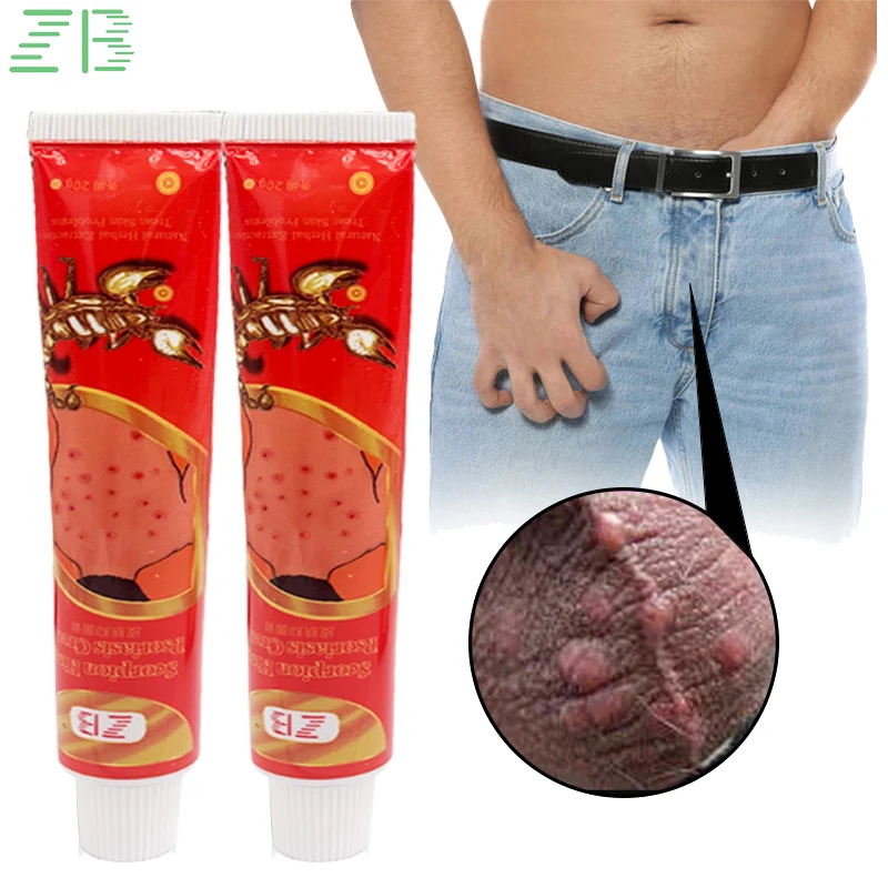 

2pcs Anti-itch Psoriasis Treatment Ointment Effective Against Fungi Private Parts Itching Dermatitis Red Rash Skin Cream