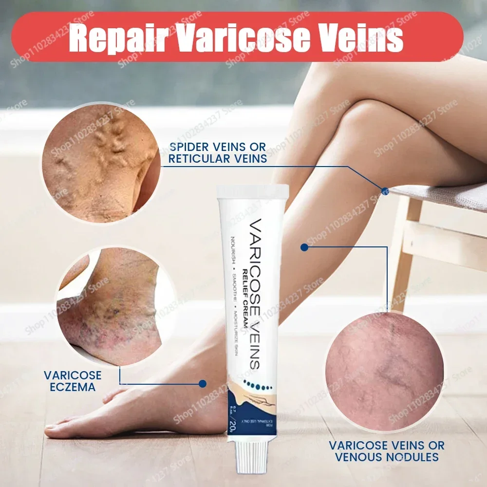 HOT SALE Varicose Veins Ointment Eliminates Spider Legs Skin Health Care