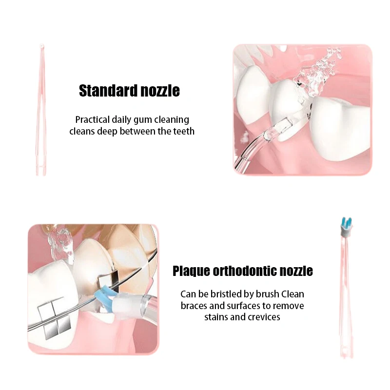 4 Teile/satz Austauschbare Oral Dental Düsen Für Munddusche Dental Wasser Jet Mundwasser Flosser