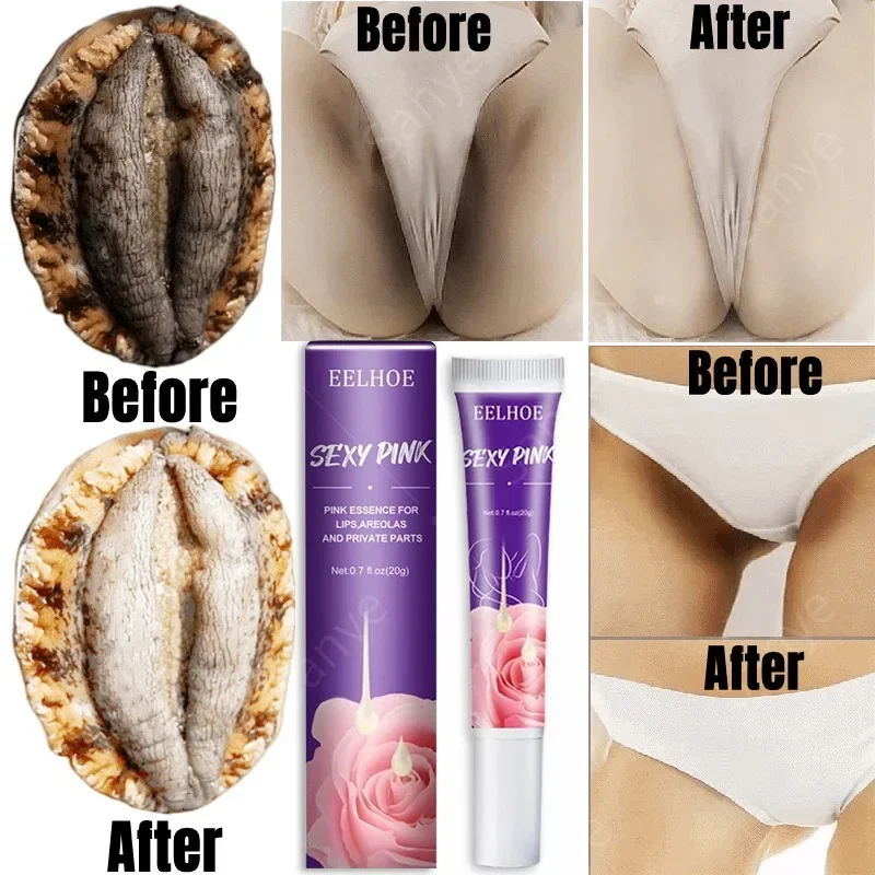 Women Skin Brightening Cream Remove Melanin Emulsion Brighten Private Parts Lightening Cream Inner Thigh Butt Bleaching Serum