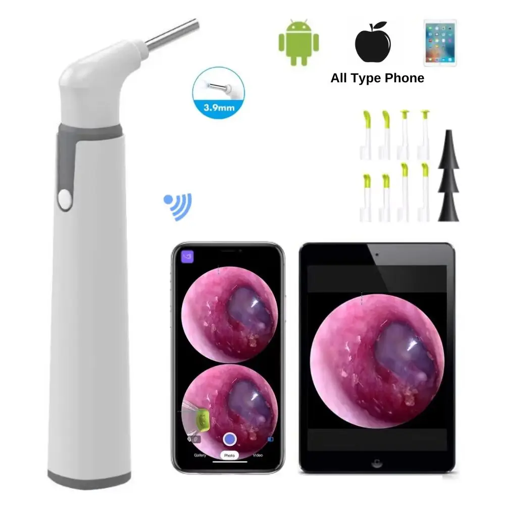 

1080P WIFI Visual Otoscope Ear Endoscope Camera Medical Ear Wax Cleaner Camera for Ears Nose Skin Support IOS Android