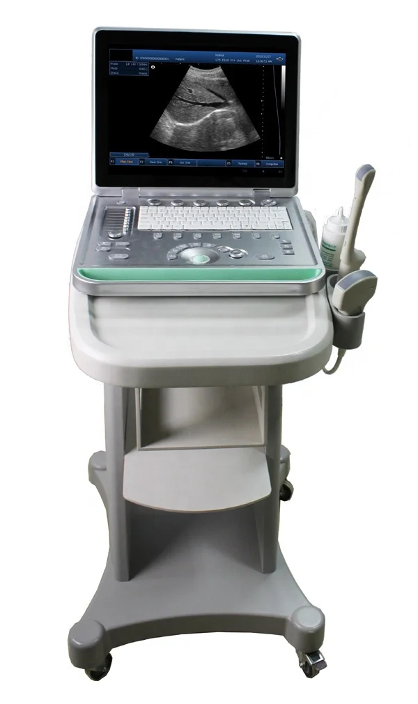 Good Image 15inch LCD Portable Medical Ultrasound Machine Laptop for gestation