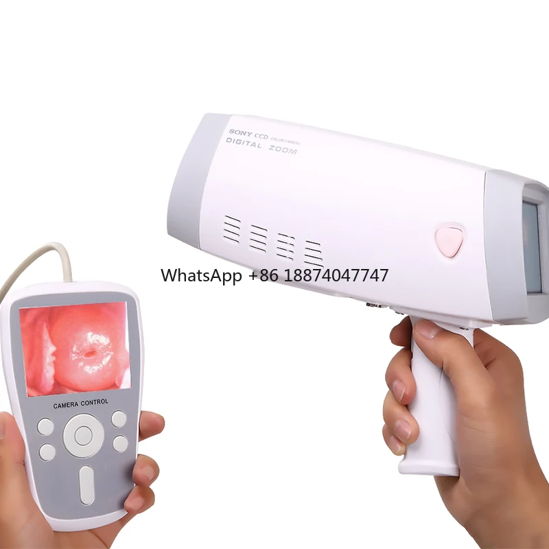 Simple innovative products Professional grade high end with Tripod Hospital Gynecology inspection equipment Video