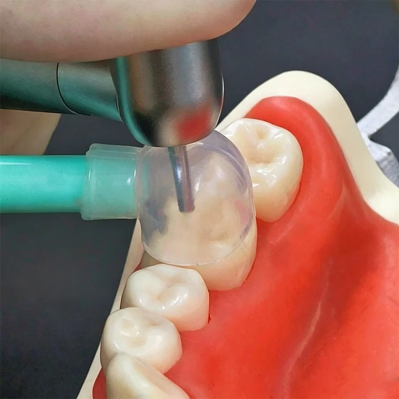 Dental Tiny Cover for Aluminum Oxide Air Abrasion Micro Blaster Sandblaster Powder Dust Proof Cap134℃ Autoclave