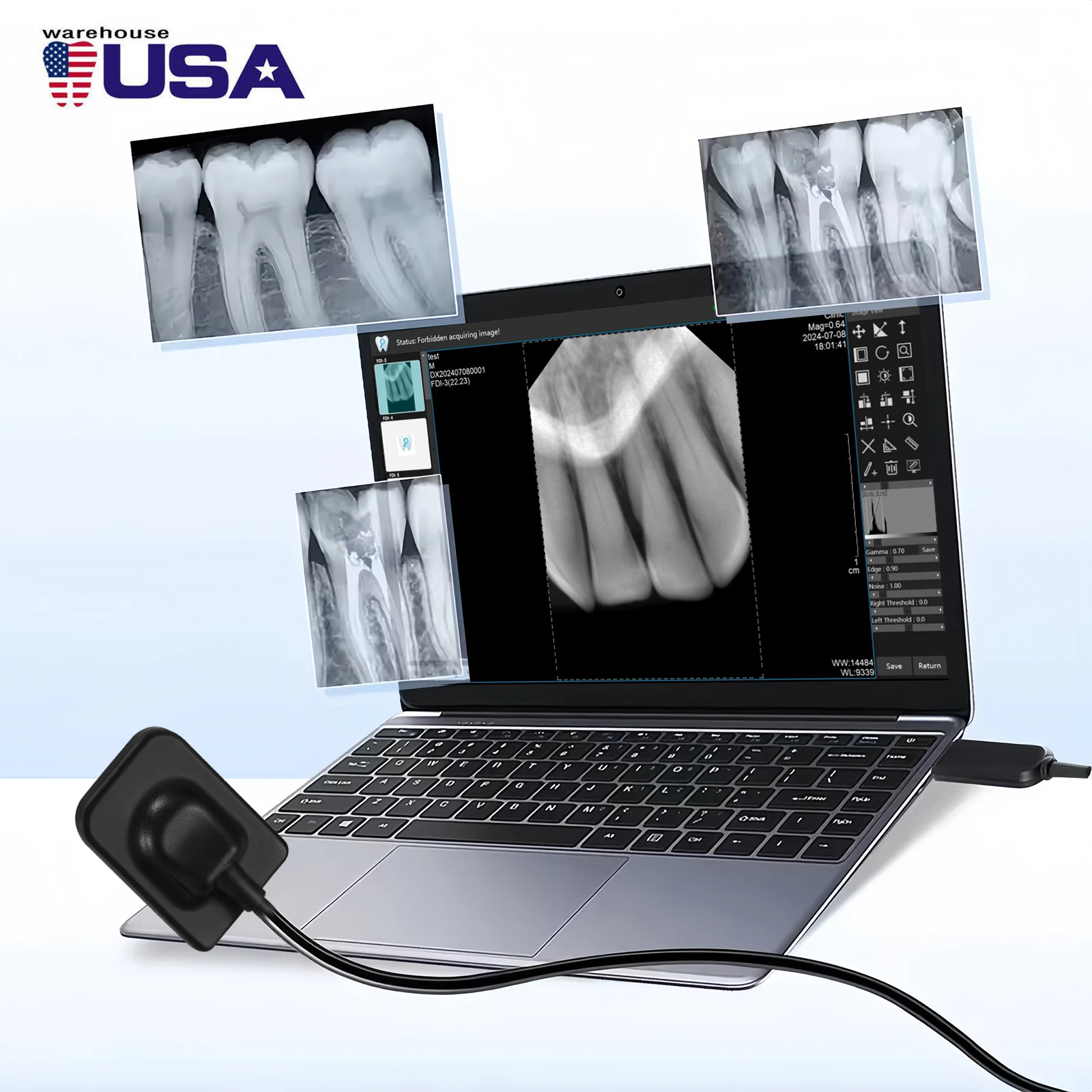 Dental X ray Sensor Digital Sensor Rayos Digital Imaging System Sensor Holder