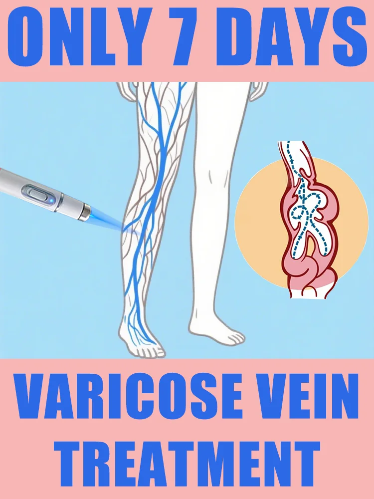 

blue light pen solve varicose veins, hot sale leg care tools